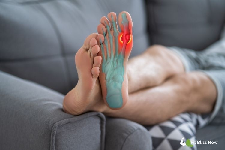 What is Gout?